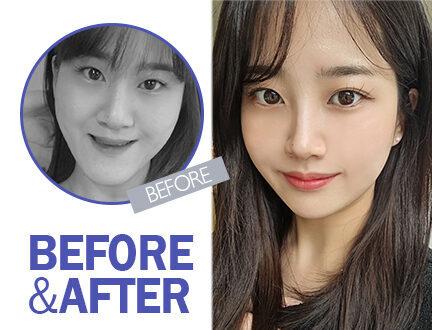 정다은님의 리얼스토리