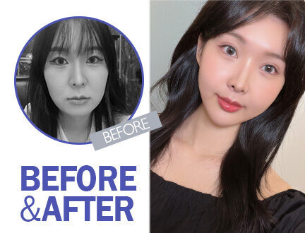 차은서님의 리얼스토리