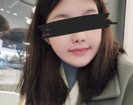 양악 6개월 후기입니다~