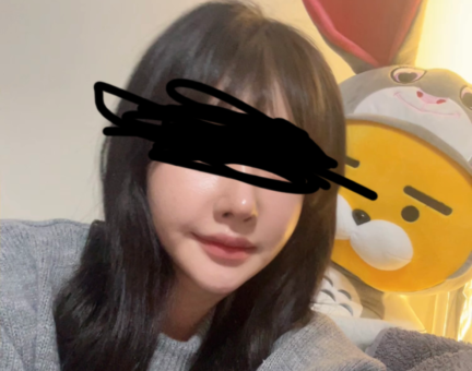 양악후기