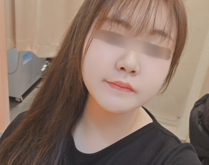 양악수술 6개월후기