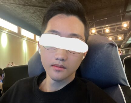 양악수술 6개월 후기입니다