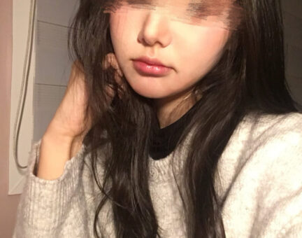 양악수술 후 6개월 리얼한후기